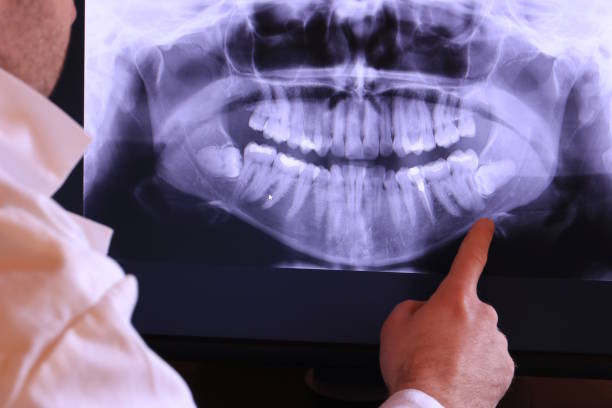 Best Emergency Root Canal Treatment in Ypsilanti, MI