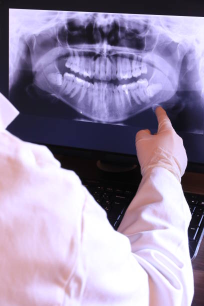 Best Emergency Dentist for Special Needs Patients in Ypsilanti, MI